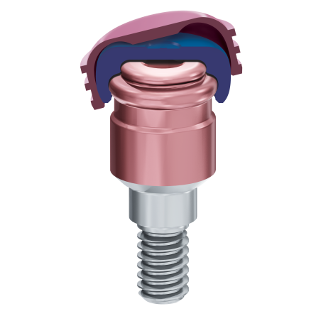 ZEST DENTAL - LOCATOR RTX